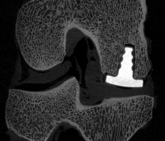 Goat Knee scan from SkyScan 1173 Micro-CT