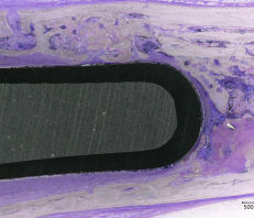 Image from the Keyence VHX-6000 3D-microscope
