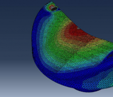 Abaqus Trochlear Implant