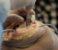 Cadaver Laboratory