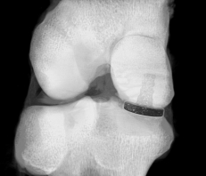 Goat Knee scan from SkyScan 1173 Micro-CT